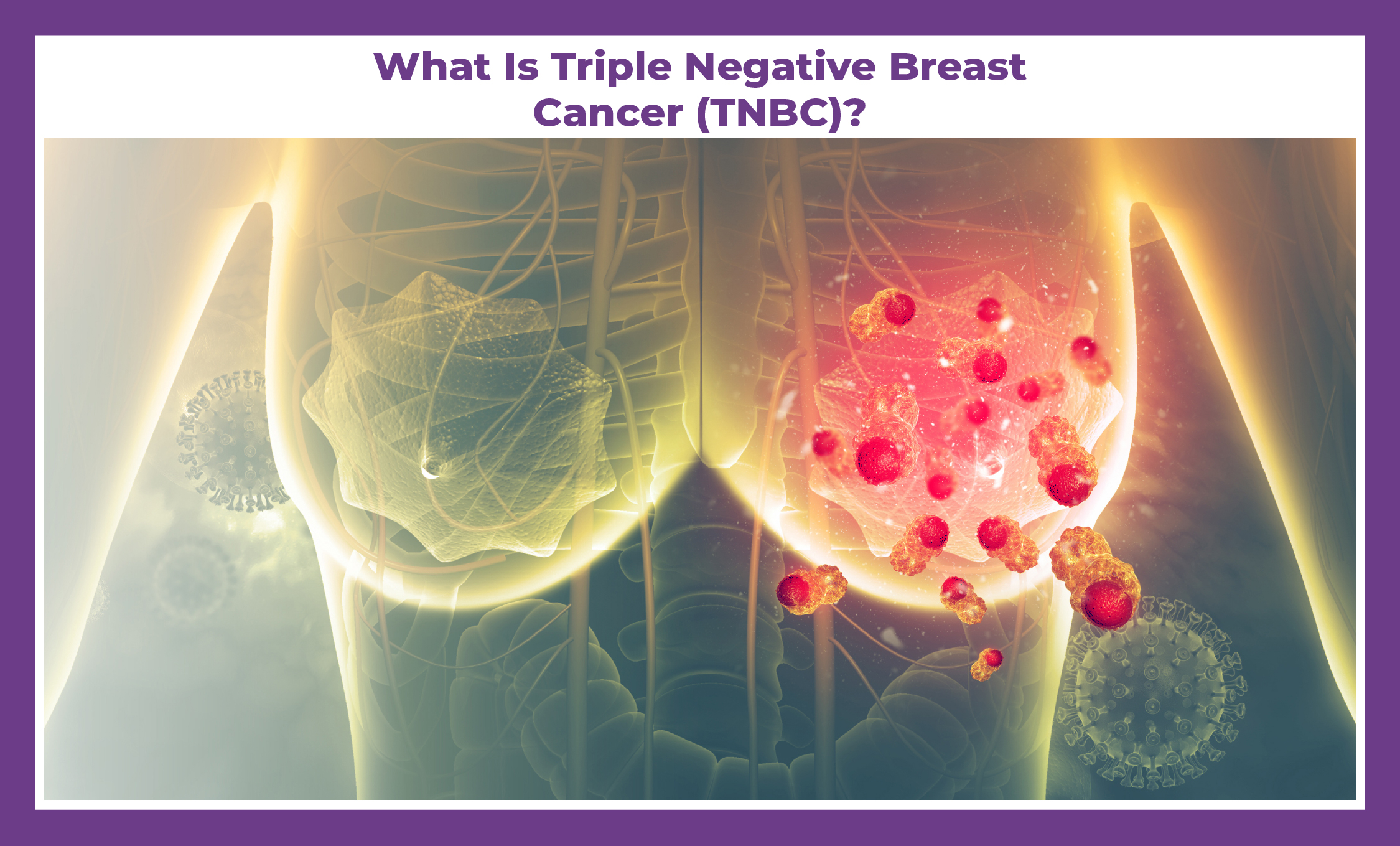 Triple Negative Breast Cancer Treatment in Delhi | Dr Deepak Jha