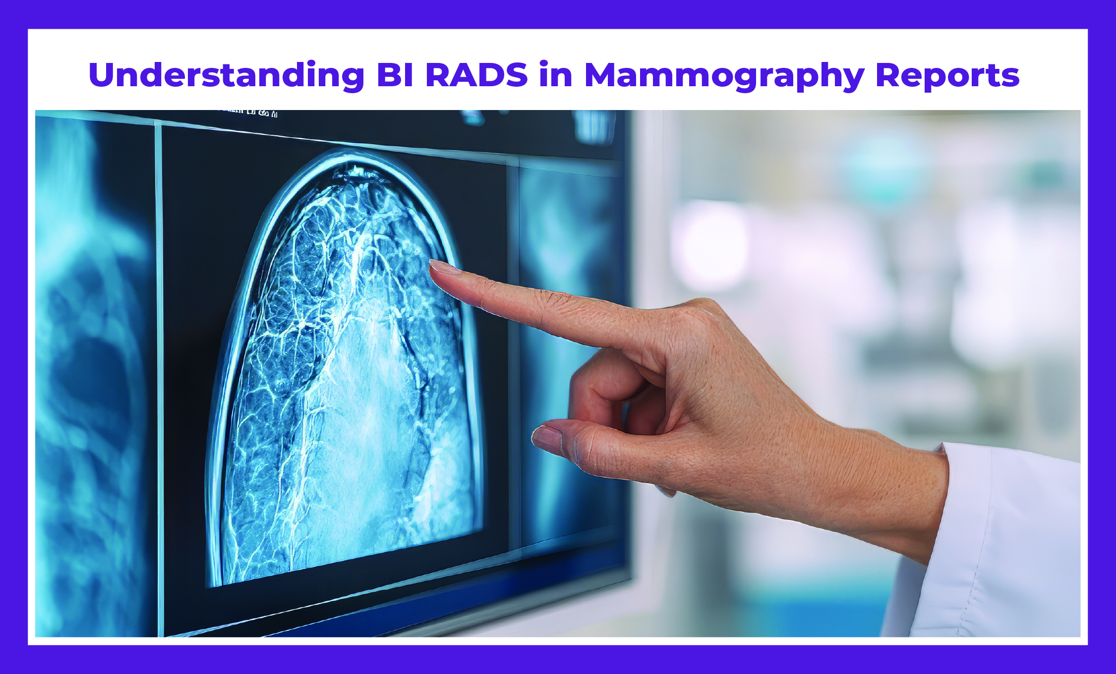 Understanding BI-RADS in Mammography Reports | Insights by Dr. Deepak Jha – Best Breast Cancer Surgeon in Gurgaon