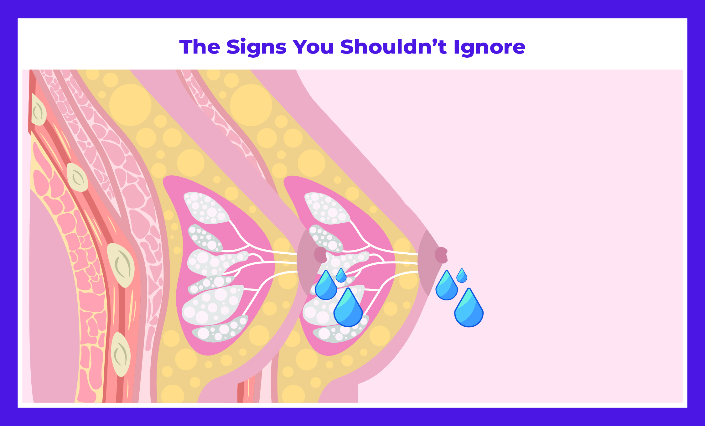 Nipple Discharge Explained: Signs You Shouldn’t Ignore | Expert Insights by Dr. Deepak Jha